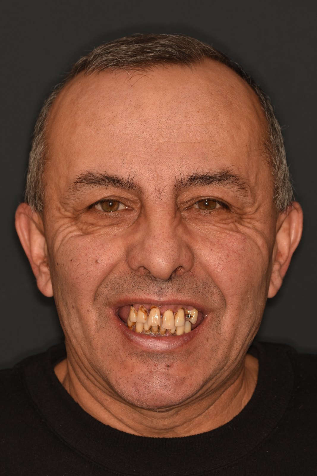Zâmbetul înainte de tratament